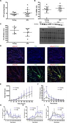 Peptide YY (PYY) Is Expressed in Human Skeletal Muscle Tissue and Expanding Human Muscle Progenitor Cells
